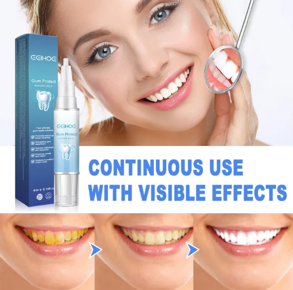 Teeth Repair Gel (Copy)