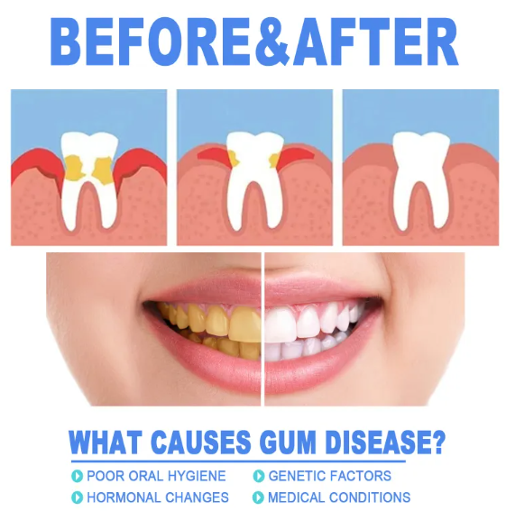 Teeth Repair Gel (Copy)
